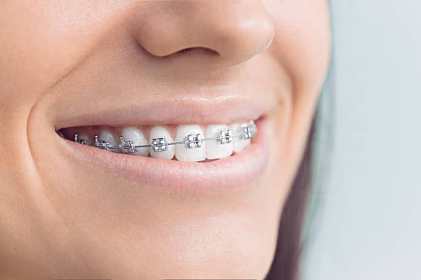 Best Dental Inlays and Onlays  in Livermore, CA